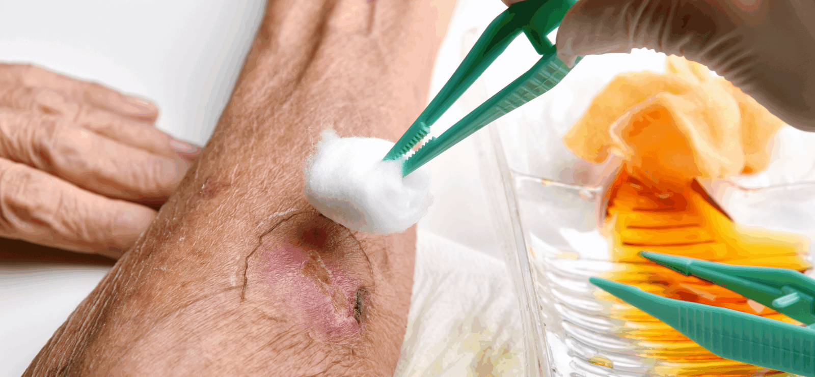 Infection Control & Dressing Care